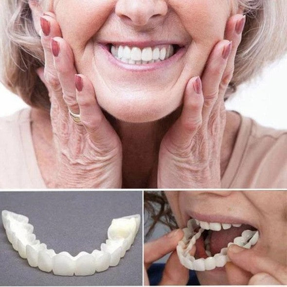 Instant Smile Veneers – Upper & Lower Clip-On Dental Veneer Set
