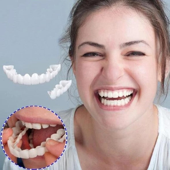 Instant Smile Veneers – Upper & Lower Clip-On Dental Veneer Set