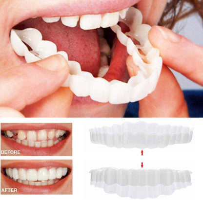 Instant Smile Veneers – Upper & Lower Clip-On Dental Veneer Set