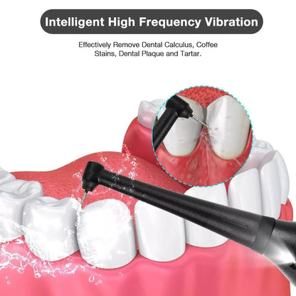 Dental Calculus Removal at Home