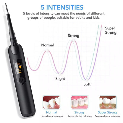 Dental Calculus Removal at Home